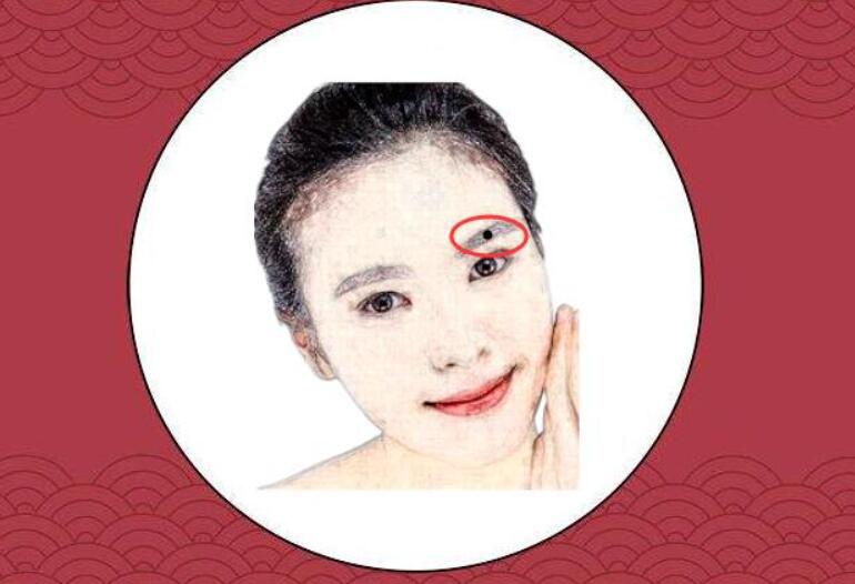 有痣不要乱点，有些痣是可以给你带来好运的 面相算命大全